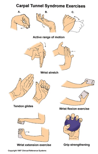 carpal-tunnel-syndrome-exercises