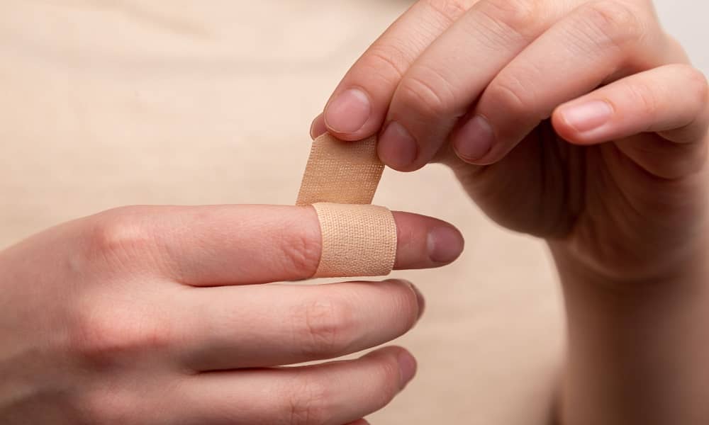treatment for swollen fingers