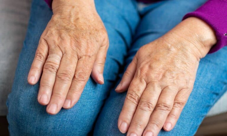 why-does-skin-lose-elasticity-with-aging-768x461.jpg